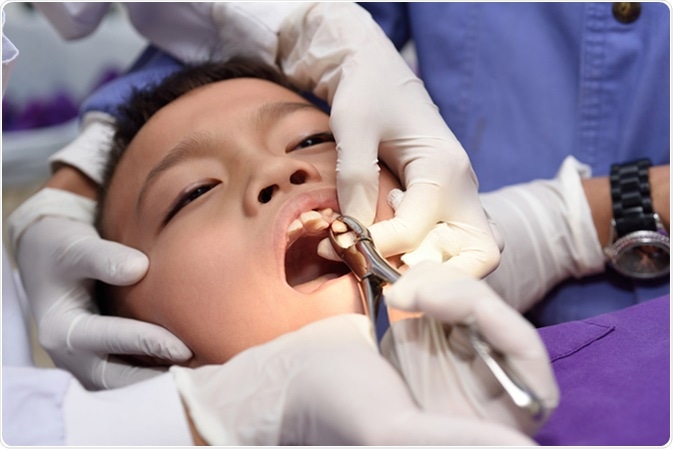 Young boy during dental extraction. Image Credit: ARZTSAMUI / Shutterstock